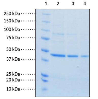 Lane 1: MW Markers<br />Lane 2: SPHK1 (4 μg)<br />Lane 3: SPHK1 (2 μg)<br />Lane 4: SPHK1 (1 μg)